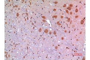 Immunohistochemistry (IHC) analysis of paraffin-embedded Rat Brain, antibody was diluted at 1:100. (MANF Antikörper  (Internal Region))