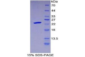 Protease (Ser1) protein