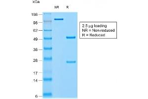 SDS-PAGE Analysis of Purified CHGA Mouse Recombinant Monoclonal Antibody ABIN6383803. (Rekombinanter Chromogranin A Antikörper)