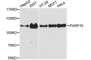 Western blot analysis of extracts of various cell lines, using PARP10 antibody. (PARP10 Antikörper  (AA 1-300))