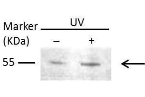WB Image Sample (30 ug of whole cell lysate) A: Raji 10% SDS PAGE antibody diluted at 1:1000 (MMP1 Antikörper)