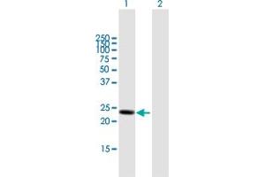 Western Blot analysis of LYPLA1 expression in transfected 293T cell line by LYPLA1 MaxPab polyclonal antibody.