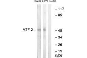 Western blot analysis of extracts from HepG2/LOVO cells, using ATF2 (Ab-69 or 51) Antibody. (ATF2 Antikörper  (AA 35-84))