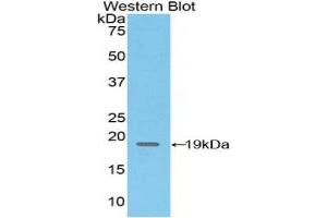Western blot analysis of the recombinant protein. (CD97 Antikörper  (AA 32-173))