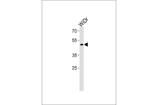 TFDP3 Antikörper  (N-Term)