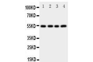 Western Blotting (WB) image for anti-Cystatin A (Stefin A) (CSTA) (AA 77-90), (C-Term) antibody (ABIN3042657) (CSTA Antikörper  (C-Term))
