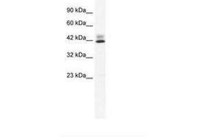 Image no. 2 for anti-Zinc Finger Protein 551 (ZNF551) (AA 169-218) antibody (ABIN203081) (ZNF551 Antikörper  (AA 169-218))