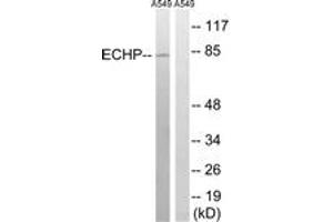 Western Blotting (WB) image for anti-Enoyl-CoA, Hydratase/3-Hydroxyacyl CoA Dehydrogenase (EHHADH) (AA 476-525) antibody (ABIN2890487) (EHHADH Antikörper  (AA 476-525))