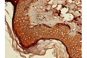 Immunohistochemistry (IHC) image for anti-Hydroxy-delta-5-Steroid Dehydrogenase, 3 beta- and Steroid delta-Isomerase 1 (HSD3B1) (AA 127-267) antibody (ABIN7142284)