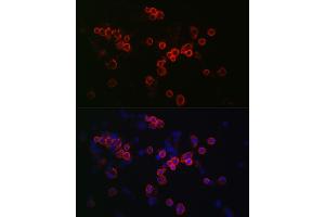 Immunofluorescence analysis of R. (CCR7 Antikörper  (AA 1-100))