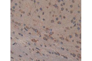 Used in DAB staining on fromalin fixed paraffin- embedded brain tissue (PTPN5 Antikörper  (AA 270-533))