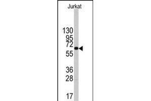 Western blot analysis of anti-PFKFB1 Antibody (Center) (ABIN392772 and ABIN2842216) in Jurkat cell line lysates (35 μg/lane). (PFKFB1 Antikörper  (AA 259-289))