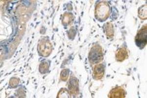 Immunohistochemistry analysis of paraffin-embedded mouse skin using,alpha Actinin (ABIN7073023) at dilution of 1: 900