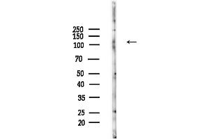 anti-Xin Actin-Binding Repeat Containing 1 (XIRP1) (pSer295) antibody