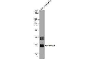 WB Image MMP10 antibody detects MMP10 protein by western blot analysis. (MMP10 Antikörper)