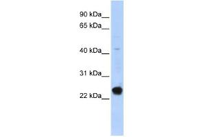 WB Suggested Anti-C16orf80 Antibody Titration:  0. (C16orf80 Antikörper  (Middle Region))
