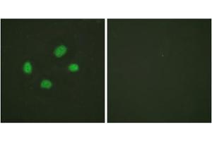 Immunofluorescence analysis of HeLa cells, using Chk2 (Phospho-Thr383) antibody. (CHEK2 Antikörper  (pThr383))