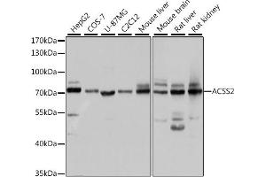 Western blot analysis of extracts of various cell lines, using  antibody (ABIN6131387, ABIN6136467, ABIN6136469 and ABIN6222130) at 1:1000 dilution. (ACSS2 Antikörper)
