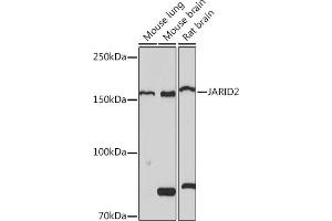 Western blot analysis of extracts of various cell lines, using J Rabbit mAb (ABIN7268047) at 1:1000 dilution. (JARID2 Antikörper)