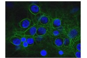 Immunofluorescence of cultured rat neurons and glia showing axonal and dendritic staining of alpha II spectrin (green) revealing the submembranous cytoskeleton and DNA (blue). (SPTAN1 Antikörper)