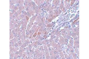 Immunohistochemical staining of rat liver tissue with LYRM1 polyclonal antibody  at 5 ug/mL dilution.