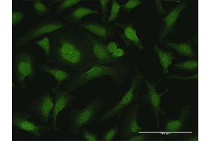 Immunofluorescence of purified MaxPab antibody to CYTH2 on HeLa cell. (Cytohesin 2 Antikörper  (AA 1-400))