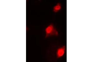 Immunofluorescent analysis of RAD51C staining in HeLa cells.