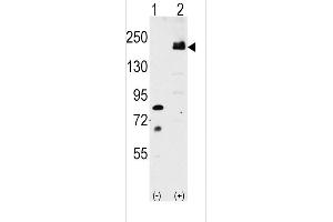 Western blot analysis of LRP6 (arrow) using rabbit polyclonal LRP6 Antibody (C-term ) (ABIN390100 and ABIN2840612).