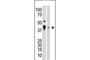 Antibody is used in Western blot to detect MBD2 in A375 cell lysate (lane 1) and mouse brain tissue lysate (lane 2) lysate. (MBD2 Antikörper  (N-Term))