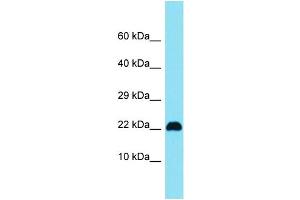 Host: Rabbit Target Name: C15orf32 Sample Type: Jurkat Whole Cell lysates Antibody Dilution: 1. (C15ORF32 Antikörper  (N-Term))