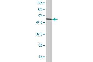 Western Blotting (WB) image for anti-Cytochrome B5 Reductase 3 (CYB5R3) (AA 1-301) antibody (ABIN560603)