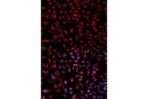 Immunofluorescence analysis of HeLa cell using DOK4 antibody. (DOK4 Antikörper  (AA 240-326))