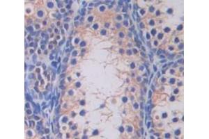 IHC-P analysis of Human Tissue, with DAB staining. (SLC26A8 Antikörper  (AA 664-970))