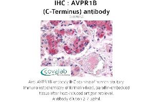 Image no. 2 for anti-Arginine Vasopressin Receptor 1B (AVPR1B) (C-Term) antibody (ABIN1732149) (AVPR1B Antikörper  (C-Term))