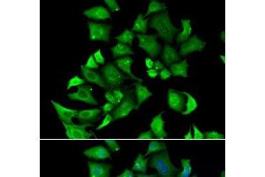 Immunofluorescence analysis of A549 cells using ENTPD2 Polyclonal Antibody (ENTPD2 Antikörper)