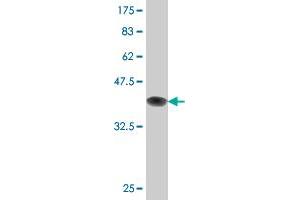 Western Blot detection against Immunogen (36. (DCP1A Antikörper  (AA 186-285))