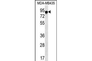 FYB Antibody (C-term) (ABIN656241 and ABIN2845557) western blot analysis in MDA-M cell line lysates (35 μg/lane). (FYB Antikörper  (C-Term))
