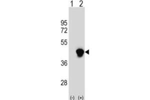 Western Blotting (WB) image for anti-Enoyl-CoA Delta Isomerase 2 (PECI) antibody (ABIN3003871) (PECI/ECI2 Antikörper)