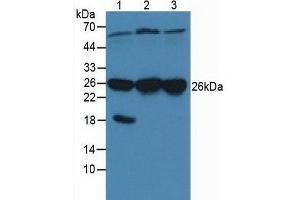 Western blot analysis of (1) Porcine Brain Tissue, (2) Human HeLa cells and (3) Human A431 Cells. (CACYBP Antikörper  (AA 2-228))