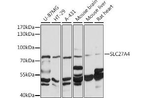 Western blot analysis of extracts of various cell lines, using F/SLC27 antibody (ABIN7270445) at 1:1000 dilution.