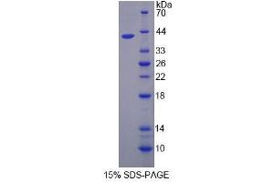 SDS-PAGE (SDS) image for Calpain 5 (CAPN5) (AA 26-343) protein (His tag) (ABIN4989645)