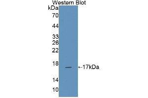 Western blot analysis of the recombinant protein. (NCR3 Antikörper  (AA 21-147))