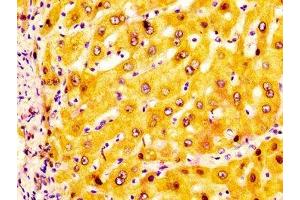 IHC image of ABIN7143641 diluted at 1:200 and staining in paraffin-embedded human liver tissue performed on a Leica BondTM system. (ADH1A Antikörper  (AA 104-253))