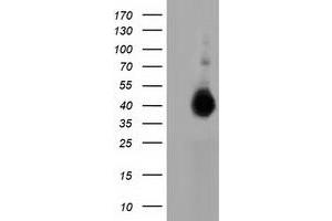 HEK293T cells were transfected with the pCMV6-ENTRY control (Left lane) or pCMV6-ENTRY FAM84B (Right lane) cDNA for 48 hrs and lysed. (FAM84B Antikörper)