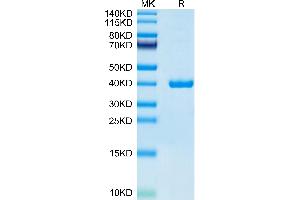 Mouse ANXA2 on Tris-Bis PAGE under reduced condition. (Annexin A2 Protein (ANXA2) (AA 2-339) (His tag))