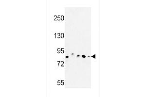 Western blot analysis of CHPF Antibody in MDA-MB435, MCF-7, HepG2, A375 cell line and mouse testis tissue lysates (35ug/lane) (CHPF Antikörper  (AA 327-354))