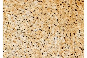 ABIN6265345 and ABIN6277877 at 1/100 staining Mouse pancreatic tissue by IHC-P.