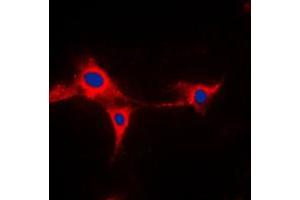 Immunofluorescent analysis of Cytochrome P450 2A13 staining in HepG2 cells. (CYP2A13 Antikörper  (Center))