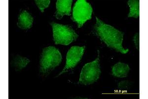 Immunofluorescence of monoclonal antibody to IKBKG on HeLa cell.