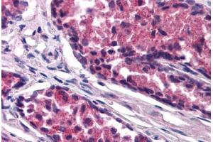 Human Prostate (formalin-fixed, paraffin-embedded) stained with SNX26 antibody ABIN290201 at 1. (SNX26 Antikörper  (AA 3-14))